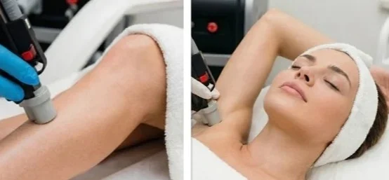 KOMPLEKT: kaenlaalused, täielik bikiinipiirkond ja sääred koos põlvedega (Tavahind 272€)